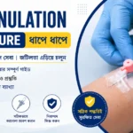 iv cannulation